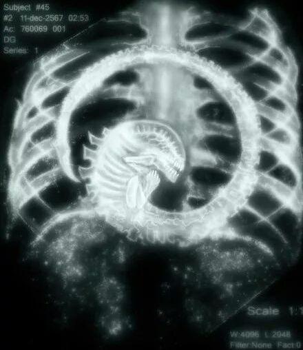 digarm of sand star digestive system,Digarm of Sand Star Digestive System: A Detailed Overview